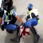 Agente de tránsito herido por dos ciudadanos, el 19 de abril de 2020.