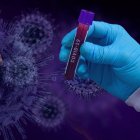 Los decesos globales por el nuevo coronavirus suman 196.295, según cifras difundidas este lunes por la OMS.