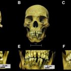 Imagen de los cráneos de los esclavos africanos que acompaña el estudio científico.