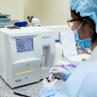 Ayer Salud señaló que se darán variaciones debido al nuevo sistema de recopilación de datos.