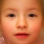 El síndrome TRAF7 genera rasgos faciales particulares. Este es un retrato robot del síndrome que puede ayudar a los pediatras a identificar a los pacientes afectados.