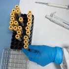 Hay más de 100 proyectos científicos que buscan la vacuna contra el nuevo coronavirus o SARS-CoV-2, causante del COVID-19.