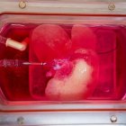 Un minihígado creado desde células de piel humana convertidas en células de hígado especializadas.
