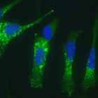 Células de adenocarcinoma pancreático mostrando activación de autofagia (puntos verdes) en respuesta al tratamiento con ABTL0812.