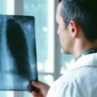 La salud pulmonar también se ve afectada entre quienes sufren de Síndrome Metabólico.