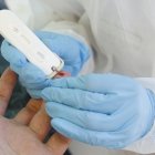 Los casos globales de coronavirus superan los 15 millones, según la OMS