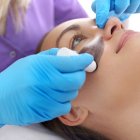 La mascarilla de carbón activado más láser Yang es el tratamiento favorito de las celebridades de Hollywood.