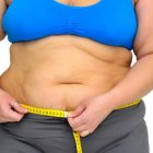 Las personas obesas, con diabetes e hipertensión, fueron los más propensos a necesitar ventilación mecánica.