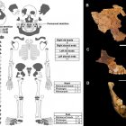 Los huesos sombreados son los hallados en el entierro. A la derecha, la reconstrucción del rostro del niño enterrado.