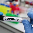 Según datos del Ministerio de Salud Pública (MSP) la semana pasada fue la más alta en casos de COVID-19, desde finales de abril e inicios de mayo.