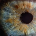 Referencial. Se trata de un dispositivo capaz de imitar la retina, la capa más interna del globo ocular cuya misión es transformar la luz que recibe en impulsos nerviosos que traslada al cerebro a través del nervio óptico.
