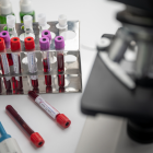 La biotecnológica está usando la tecnología de ARN mensajero para este fin.