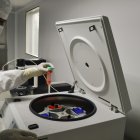 El estudio se desarrolló bajo la técnica de la bioinformatica.