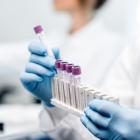 Referencial. La Organización Mundial de la Salud (OMS) señala que sólo se han administrado por ahora en el mundo unos 268 millones de dosis.