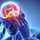 La epilepsia afecta a hombres y mujeres sin importar raza o condición social