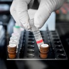 En una segunda parte del estudio, el equipo de investigación también analizó cerca de 2.000 mutaciones que han surgido en el SARS-CoV-2 desde el inicio de la pandemia.