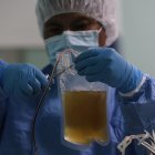 En Bolivia separan el plasma de la sangre de burro para crear un suero hiperinmune.