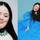 La modelo Ellie Goldstein tiene 19 años.