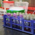 Científicos españoles han logrado identificar las moléculas que consiguen frenar la entrada del coronavirus en las células, un descubrimiento que podría abrir la puerta para desarrollar fármacos antivirales eficaces contra el SARS-CoV-2 responsable de la covid-19.