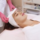 Terapia con nitrógeno líquido.