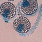 Imagen tomada a través de un microscopio que muestra un hongo Circinella lampensis.