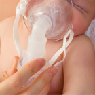 La atrofia muscular espinal (AME) es un grupo de trastornos de las neuronas motoras (células motoras).