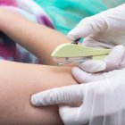 El implante debe colocarlo en médico con experiencia