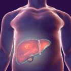 El estudio sugiere que el hígado puede desempeñar un papel en el inicio o la progresión de la enfermedad.