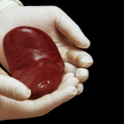 Imagen referencial de un riñón.