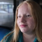 Nathaly Tite, albina de 31 años.