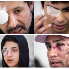 Combo de fotografías de archivo en las que se registró a Álvaro Silva, fotógrafo de 42 años (i-arriba); al estudiante universitario Ariel Flores (d-arriba); al estudiante de secundaria Jordan Fuentes (i-abajo), y al terapeuta Cristian Pozos (d-abajo), todos víctimas de traumas oculares durante la ola de protestas en Chile en 2019.