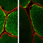 Un equipo de científicos ha identificado una enzima que resulta clave para que el ejercicio mejore nuestra salud. En la imagen, tinción que muestra las mitocondrias dentro de las fibras musculares individuales.
