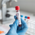 Los investigadores dicen que la variante VB provoca un declive más rápido de la fuerza del sistema inmunitario