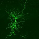 Fotografía cedida por el Instituto Cajal-CSIC de una célula piramidal el hipocampo captada en vivo.