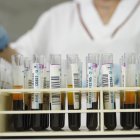 Tubos con muestras de sangre, en una imagen de archivo.