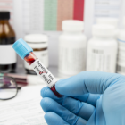 Referencial examen de hepatitis.