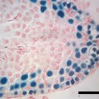 Sección transversal de un testículo de ratón infértil que muestra células germinales y espermatozoides de rata previamente congelados.