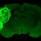 Un organoide humano trasplantado y marcado con una proteína fluorescente en una sección del cerebro de la rata.