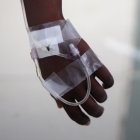 Detalle de una mano de un paciente con síntomas de cólera, en una fotografía de archivo.