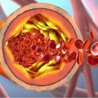 Función del colesterol bueno y malo