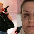 Axl Rose lamenta lo ocurrido a una de sus admiradoras, pero aclara que lanzar el micrófono es un "ritual" que realiza hace 30 años.