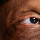 Secuelas de ataque con ácido