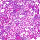 Pulmones de ratón sin píldora activa.