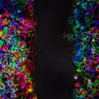 Células de cáncer de páncreas durante un proceso de migración celular. Imagen cedida por el Instituto de Tecnologías Físicas y de la Información Leonardo Torres Quevedo (ITEFI) del Consejo Superior de Investigaciones Científicas.