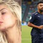 En las imágenes publicadas por la modelo se observa su rostro golpeado y con raspones