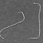 La Leptospira es la bacteria causante de esta enfermedad.
