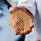 El director del Centro Nacional de Referencia para Infecciones Invasivas por Hongos, Oliver Kurzai, sostiene una placa de Petri que contiene la levadura "Candida auris".