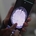 Un equipo de científicos de la Northwestern University ha conseguido que la quimioterapia más potente llegue al cerebro para tratar los gioblastomas.