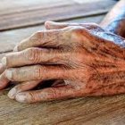 Evidencia. La piel envejecida  cicatriza deficientemente.