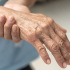 El Síndrome de Guillain Barré causa debilidad en miembros superiores e inferiores.